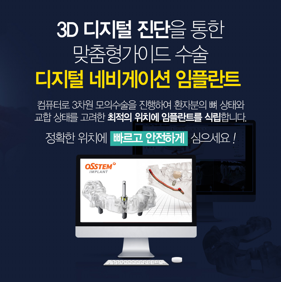 3D 디지털 진단을 통한 맞춤형가이드 수술 디지털 네비게이션 임플란트 